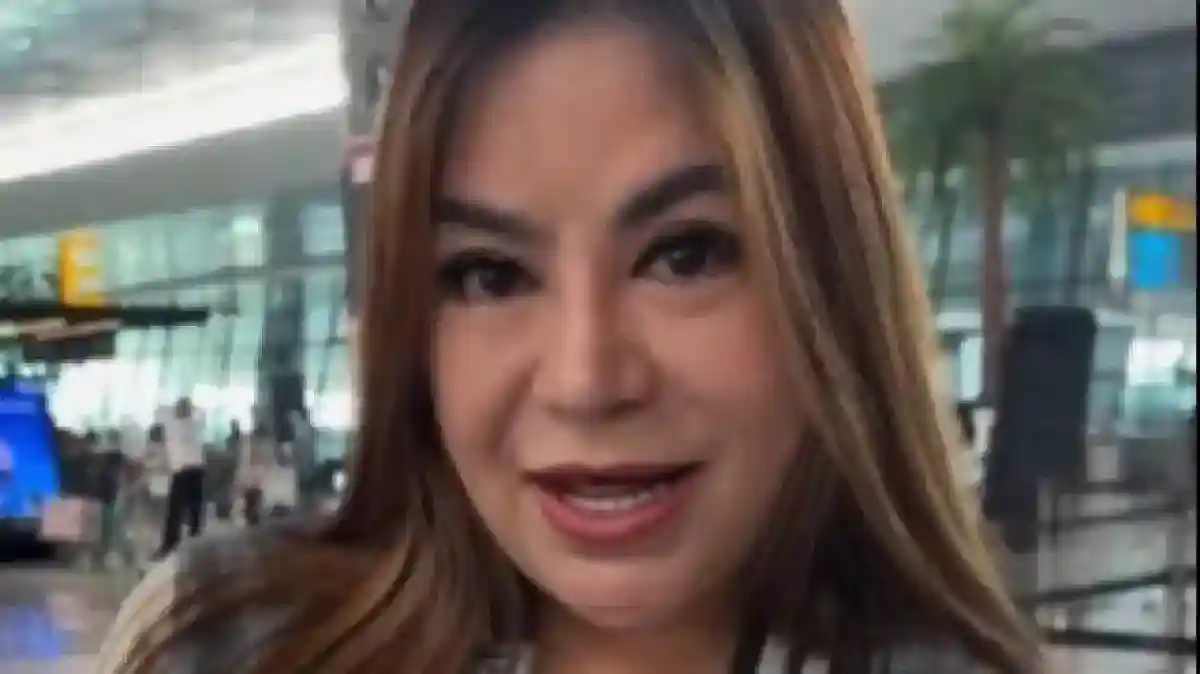 Lima Kali Operasi Hidung, Anisa Bahar Ceritakan Alasan dan Biaya Revisi
