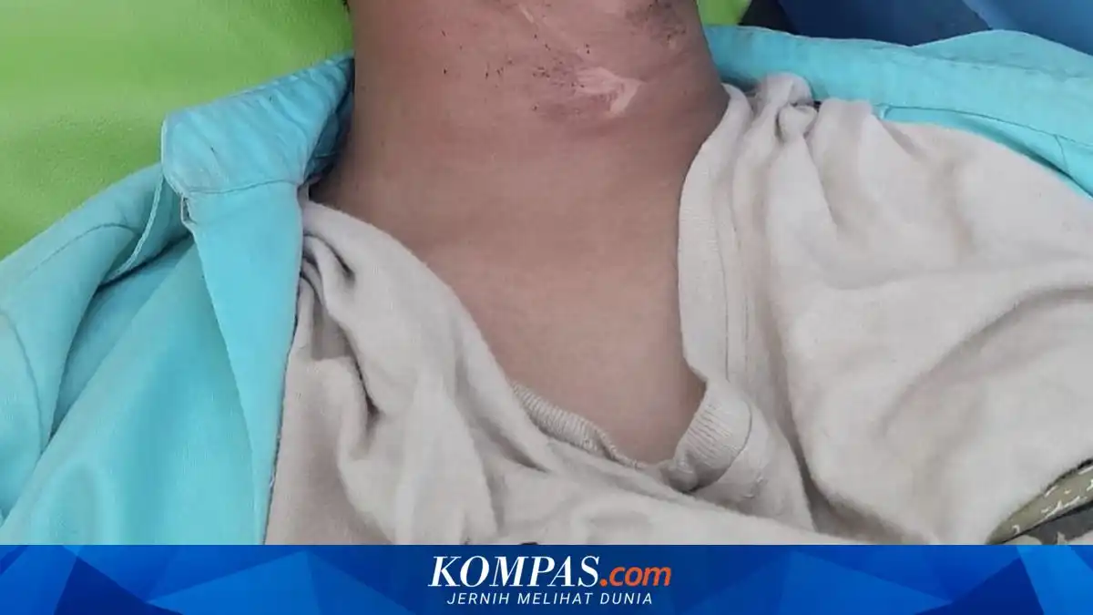 Siswa SMA Terluka Setelah Terjerat Kabel Menjuntai di Jalan Bangkalan