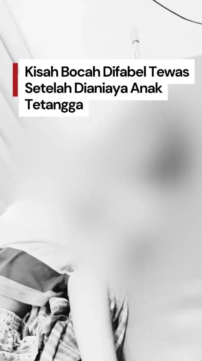 Bocah Berkebutuhan Khusus di Surabaya Meninggal Setelah Ditemukan Terjerat Tali