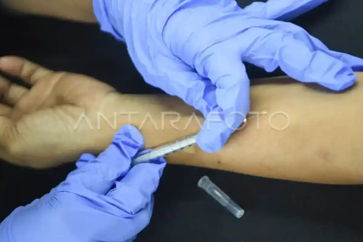BPOM Terbitkan Izin Edar untuk 43 Obat Tuberkulosis pada 2024–2026